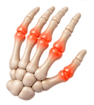 Rheumatology